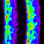 The speckle pattern obtained by the nonlinear process in paired-photon field at high intensities.